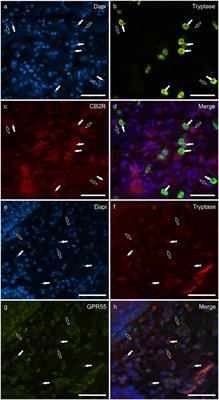 Cannabinoid receptors in the inflammatory cells of canine atopic dermatitis